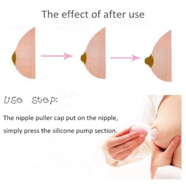 Pigeon Nipple Puller With Case Sale